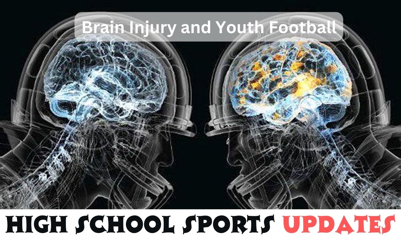 The X's and O's of Brain Injury and Youth Football