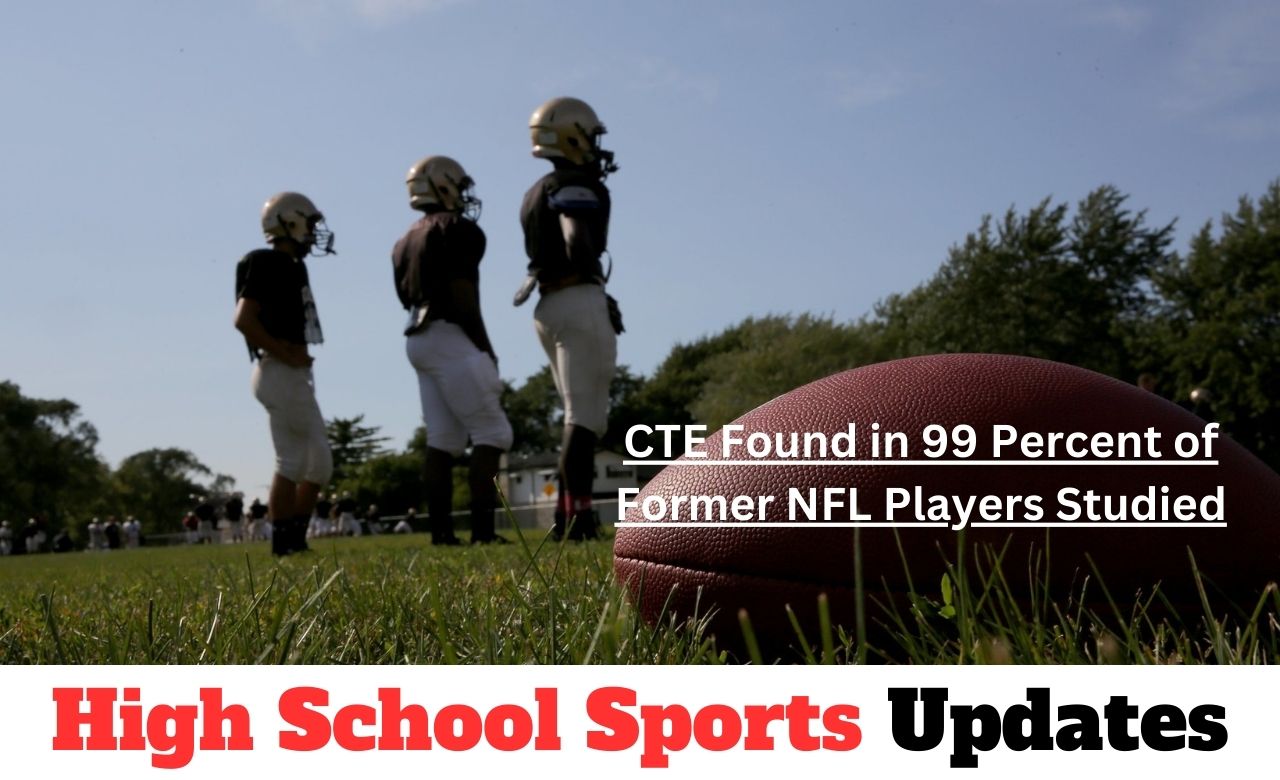 CTE Found in 99 Percent of Former NFL Players Studied